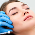 The Influence of Cleopatra Contour Plastic Surgery in Modern Beauty